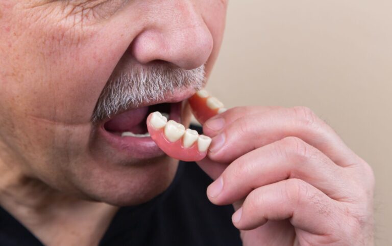 Man puts false teeth in his mouth. Photo: Unsplash