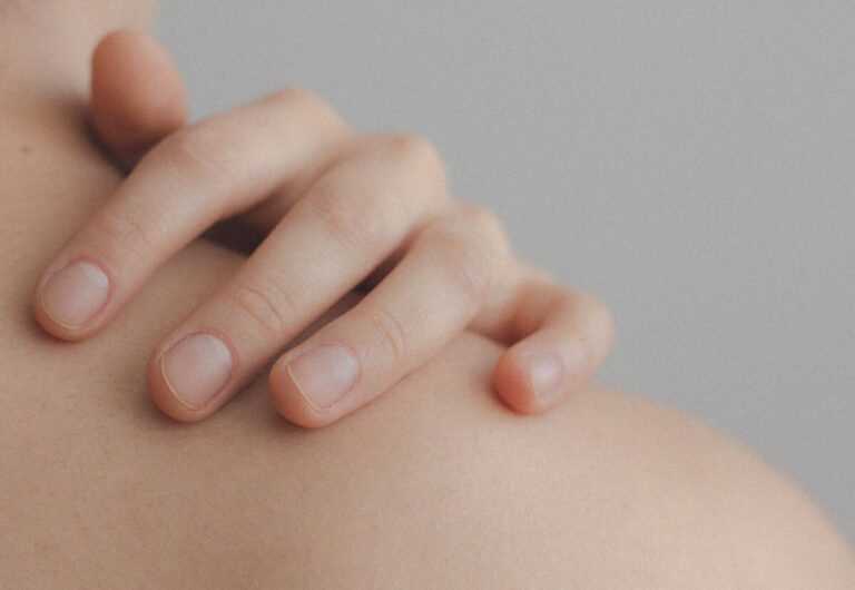 Fingers on a woman's shoulder, with bare skin. Photo: Pexels.com